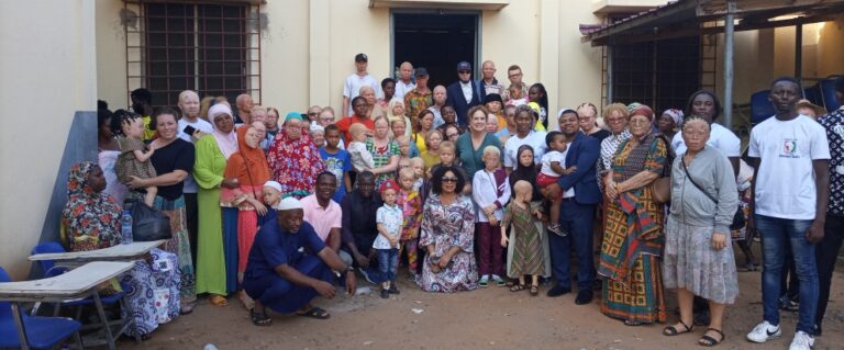 DisabilityNewsGH.com-90% Of Persons With Albinism In Ghana Suffer From Skin Cancer-ENA
