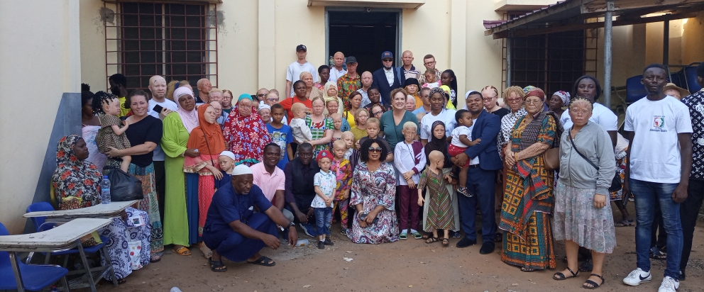 DisabilityNewsGH.com-90% Of Persons With Albinism In Ghana Suffer From Skin Cancer-ENA