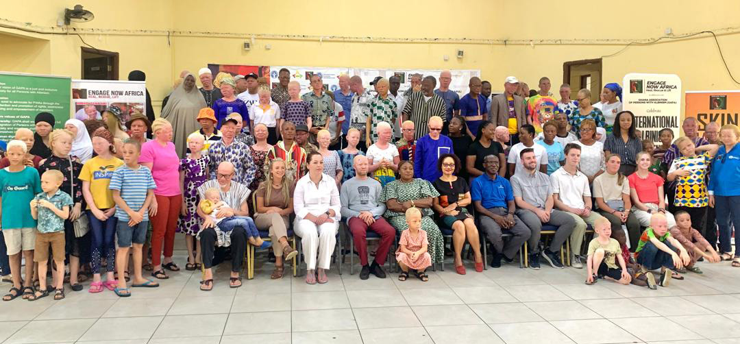 DisabilityNewsGH.com-Ghana Urged to Act on Challenges Facing People with Albinism