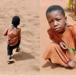 They Call Her Yaa JJ — Born The Day J.J. Rawlings Died. Now She Needs Help To Walk To School
