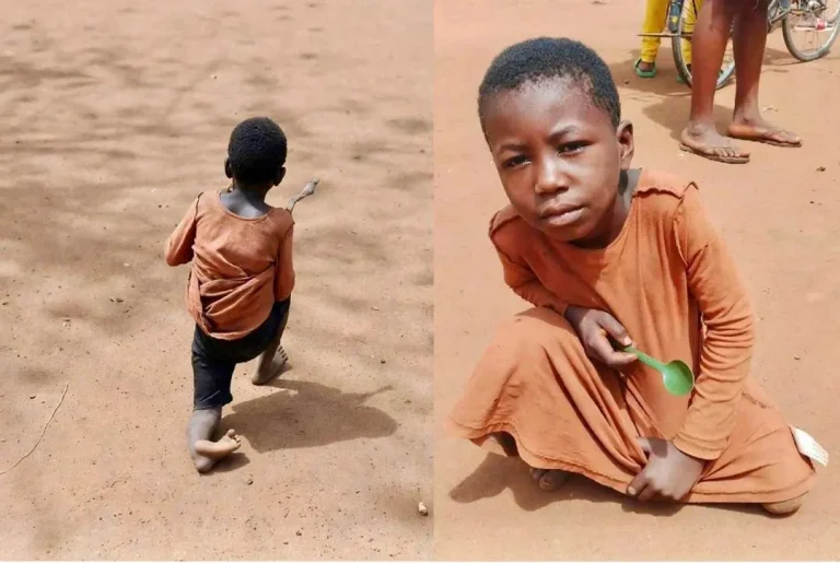 They Call Her Yaa JJ — Born The Day J.J. Rawlings Died. Now She Needs Help To Walk To School